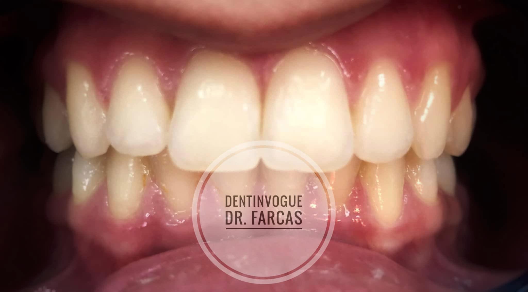 Imagine cover pentru Dentinvogue